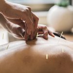 Acupuncture Clinic in East Falls