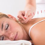 What to expect during an acupuncture treatment