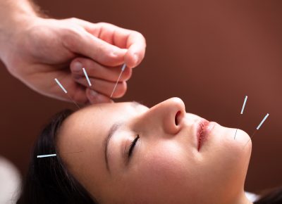 4 Reasons Why You Should Choose Acupuncture