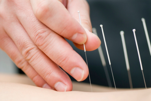 Medford, NJ Acupuncture Clinic