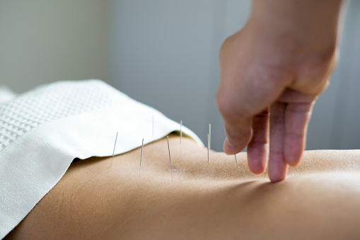 Acupuncture Clinic in Haverford, PA