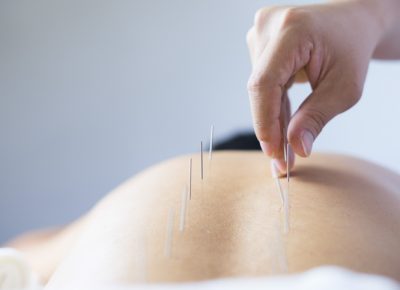 Acupuncture in South Philadelphia